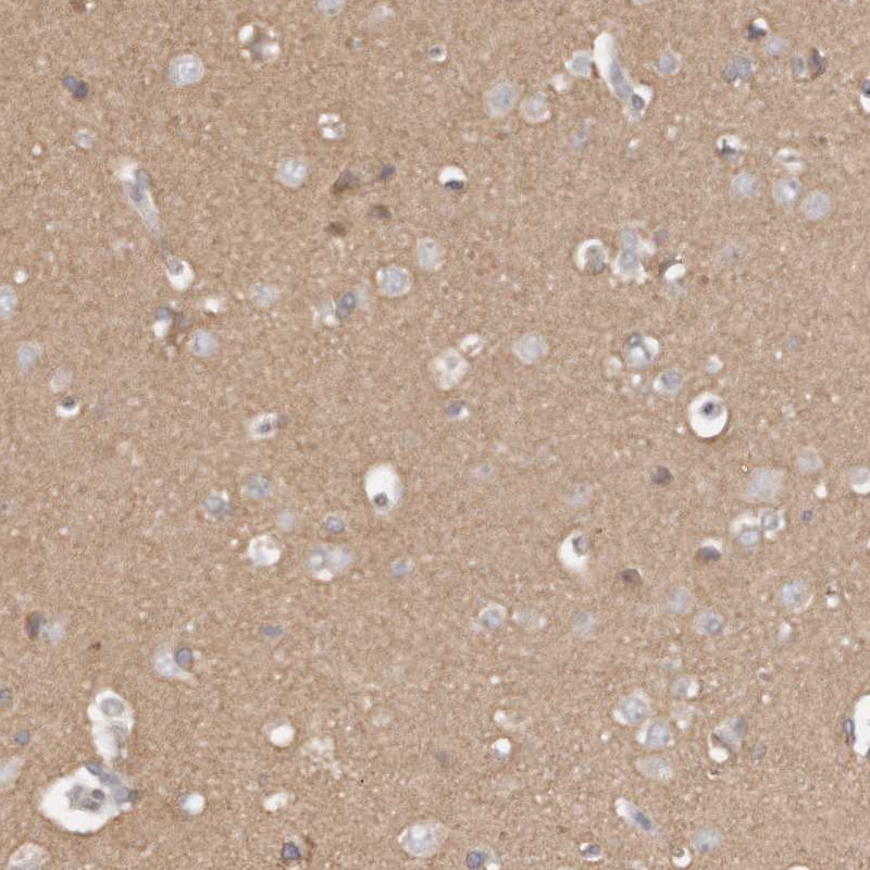 TTLL4 Antibody - BSA Free Immunohistochemistry-Paraffin: TTLL4 Antibody [NBP1-81535]