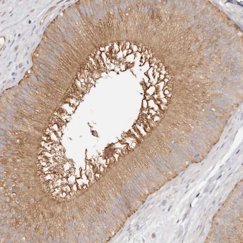 TTLL4 Antibody - BSA Free Immunohistochemistry-Paraffin: TTLL4 Antibody [NBP1-81535]