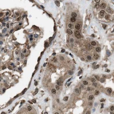 SERTAD2 Antibody - BSA Free Immunohistochemistry-Paraffin: SERTAD2 Antibody [NBP1-81542]