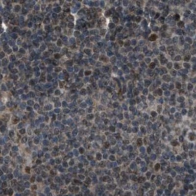 SERTAD2 Antibody - BSA Free Immunohistochemistry-Paraffin: SERTAD2 Antibody [NBP1-81542]