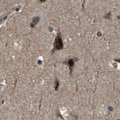 SERTAD2 Antibody - BSA Free Immunohistochemistry-Paraffin: SERTAD2 Antibody [NBP1-81542]