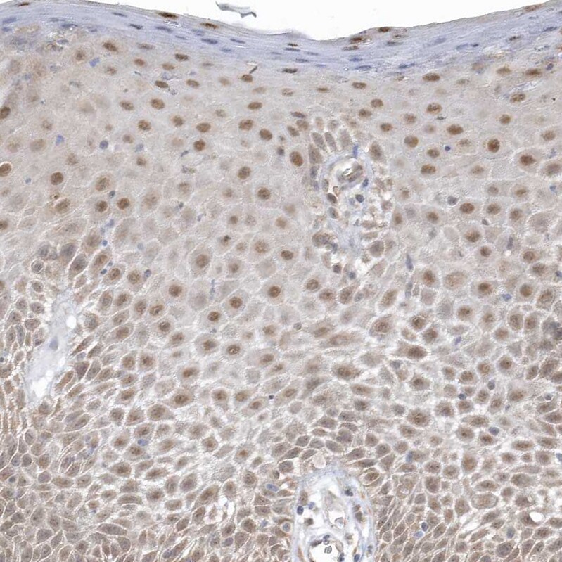 PSMD6 Antibody - BSA Free Immunohistochemistry-Paraffin: PSMD6 Antibody [NBP1-81545]