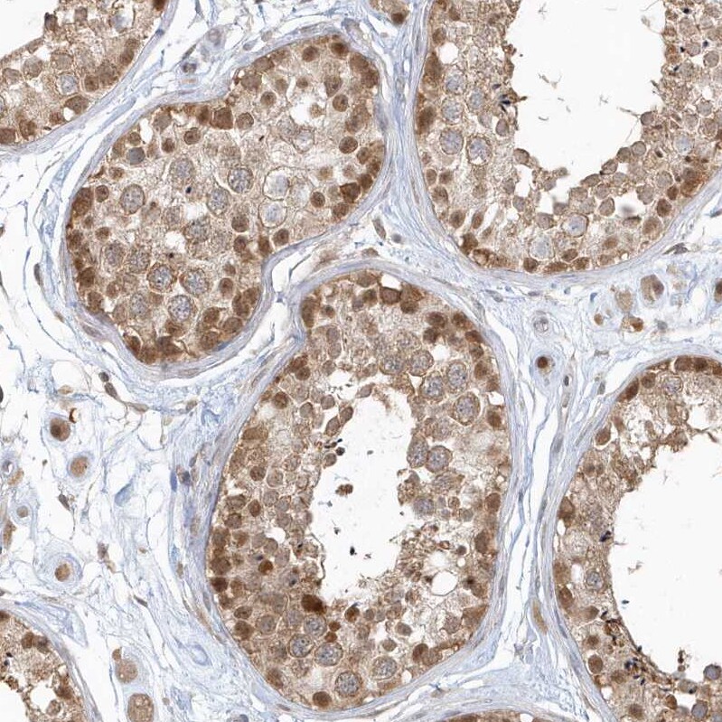 PSMD6 Antibody - BSA Free Immunohistochemistry-Paraffin: PSMD6 Antibody [NBP1-81545]