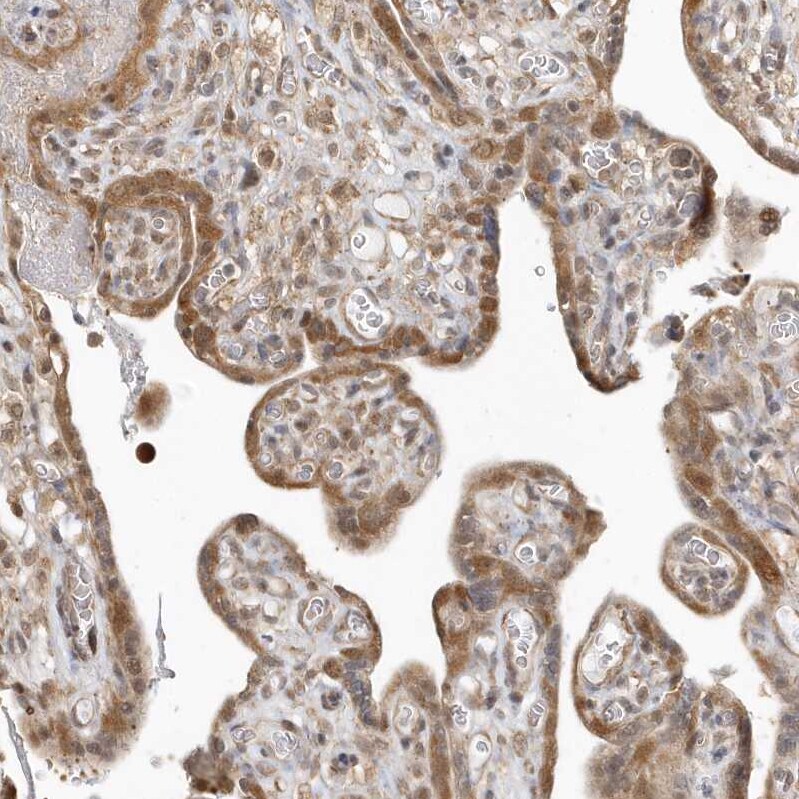 PSMD6 Antibody - BSA Free Immunohistochemistry-Paraffin: PSMD6 Antibody [NBP1-81545]