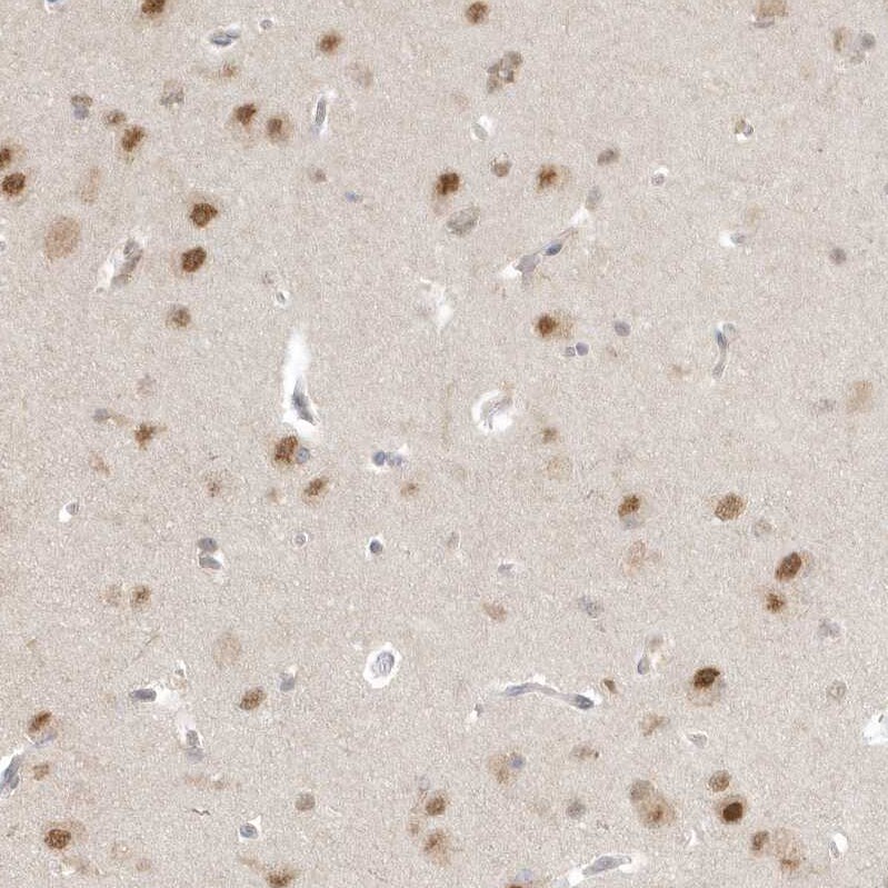 PSMD6 Antibody - BSA Free Immunohistochemistry-Paraffin: PSMD6 Antibody [NBP1-81545]