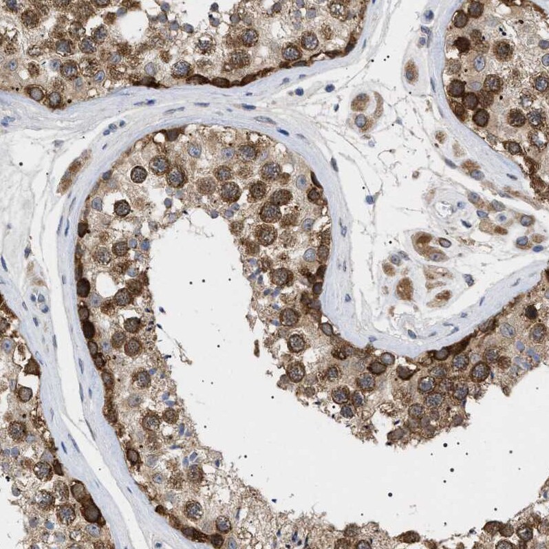 NUP93 Antibody - BSA Free Immunohistochemistry-Paraffin: NUP93 Antibody [NBP1-81546]