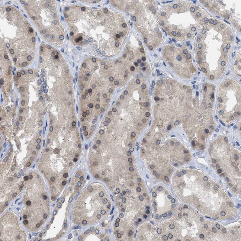 NUP93 Antibody - BSA Free Immunohistochemistry-Paraffin: NUP93 Antibody [NBP1-81546]