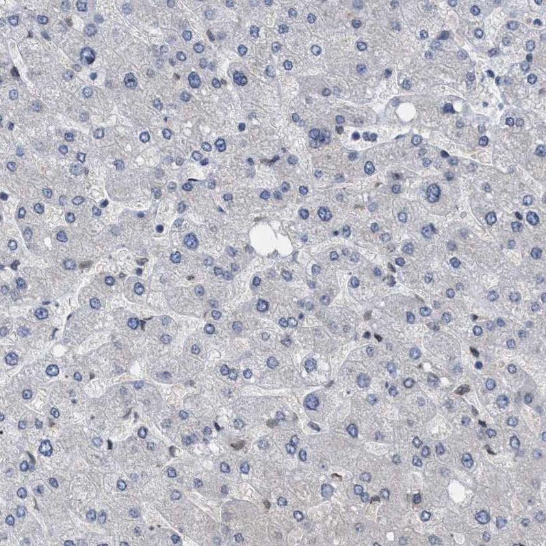 NUP93 Antibody - BSA Free Immunohistochemistry-Paraffin: NUP93 Antibody [NBP1-81546]