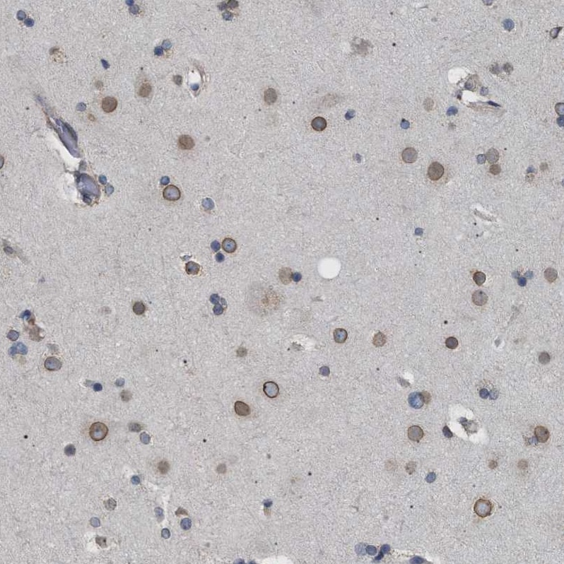 NUP93 Antibody - BSA Free Immunohistochemistry-Paraffin: NUP93 Antibody [NBP1-81546]