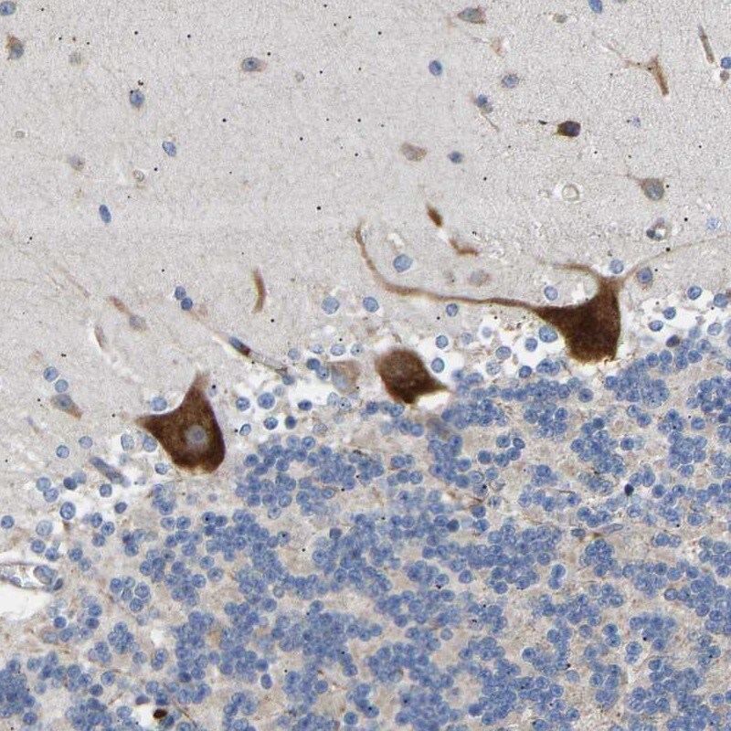 AIMP2 Antibody - BSA Free Immunohistochemistry: AIMP2 Antibody - BSA Free [NBP1-81574]
