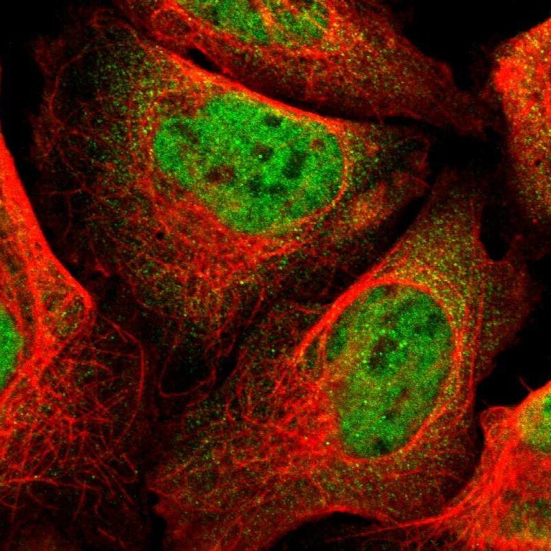 RBM3 Antibody - BSA Free Immunocytochemistry/ Immunofluorescence: RBM3 Antibody [NBP1-81580]