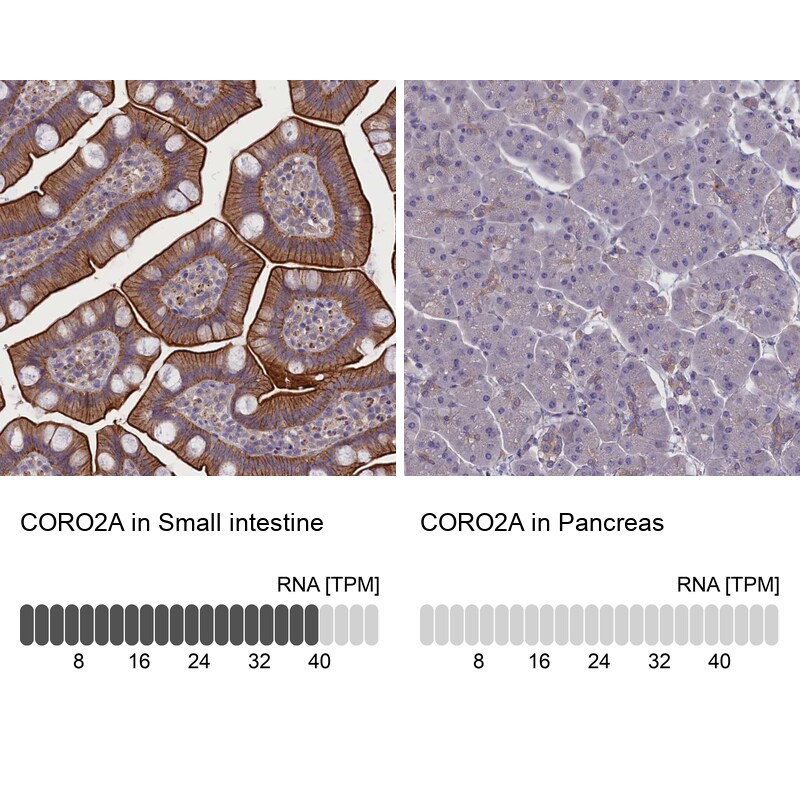 CORO2A Antibody - BSA Free Immunohistochemistry-Paraffin: CORO2A Antibody [NBP1-81582]