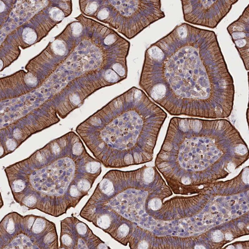 CORO2A Antibody - BSA Free Immunohistochemistry-Paraffin: CORO2A Antibody [NBP1-81582]