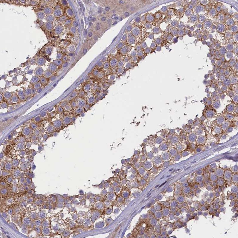 CORO2A Antibody - BSA Free Immunohistochemistry-Paraffin: CORO2A Antibody [NBP1-81582]