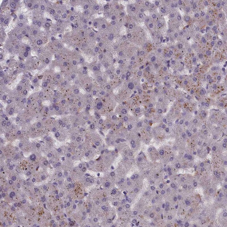 CORO2A Antibody - BSA Free Immunohistochemistry-Paraffin: CORO2A Antibody [NBP1-81582]