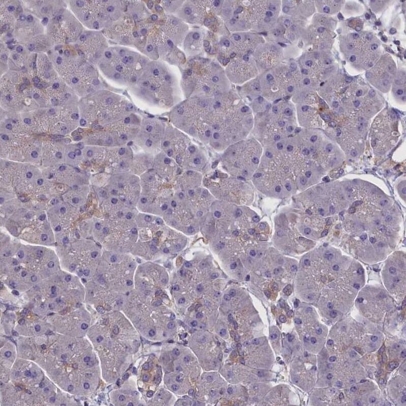 CORO2A Antibody - BSA Free Immunohistochemistry-Paraffin: CORO2A Antibody [NBP1-81582]