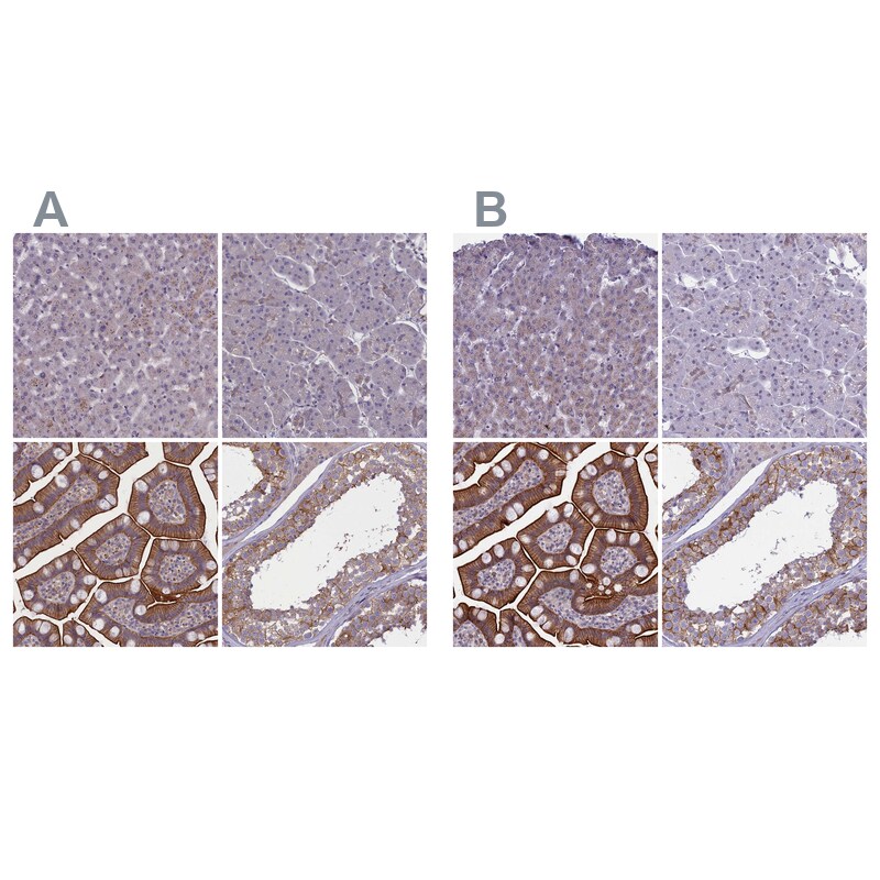 CORO2A Antibody - BSA Free Immunohistochemistry-Paraffin: CORO2A Antibody [NBP1-81582]