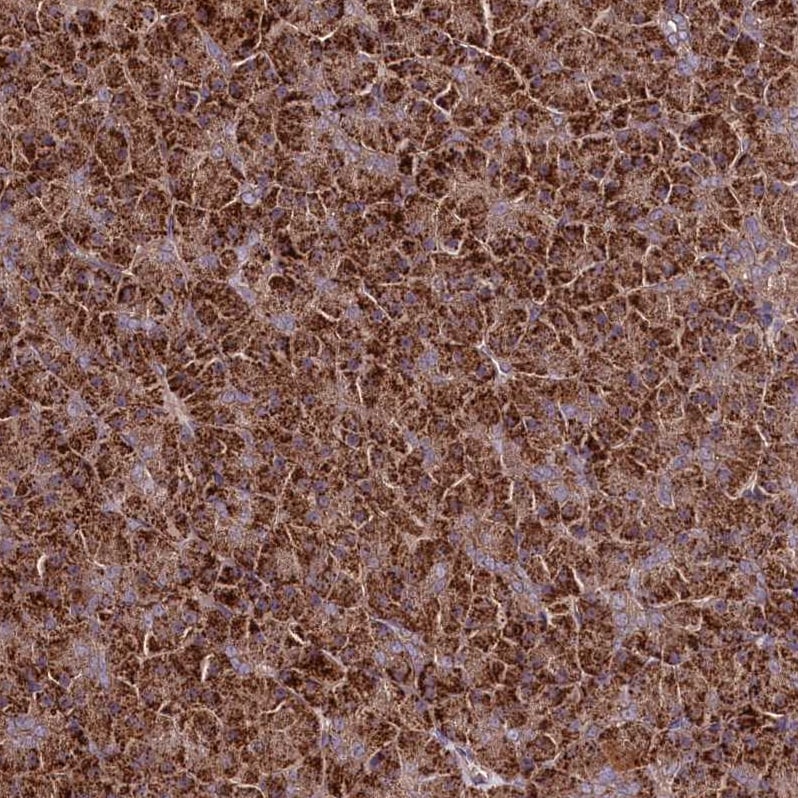 TNPO3 Antibody - BSA Free Immunohistochemistry-Paraffin: TNPO3 Antibody [NBP1-81585]