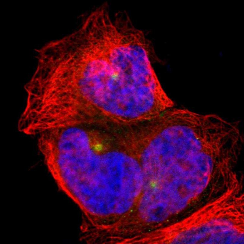 PLA2G6 Antibody - BSA Free Immunocytochemistry/ Immunofluorescence: PLA2G6 Antibody [NBP1-81586]