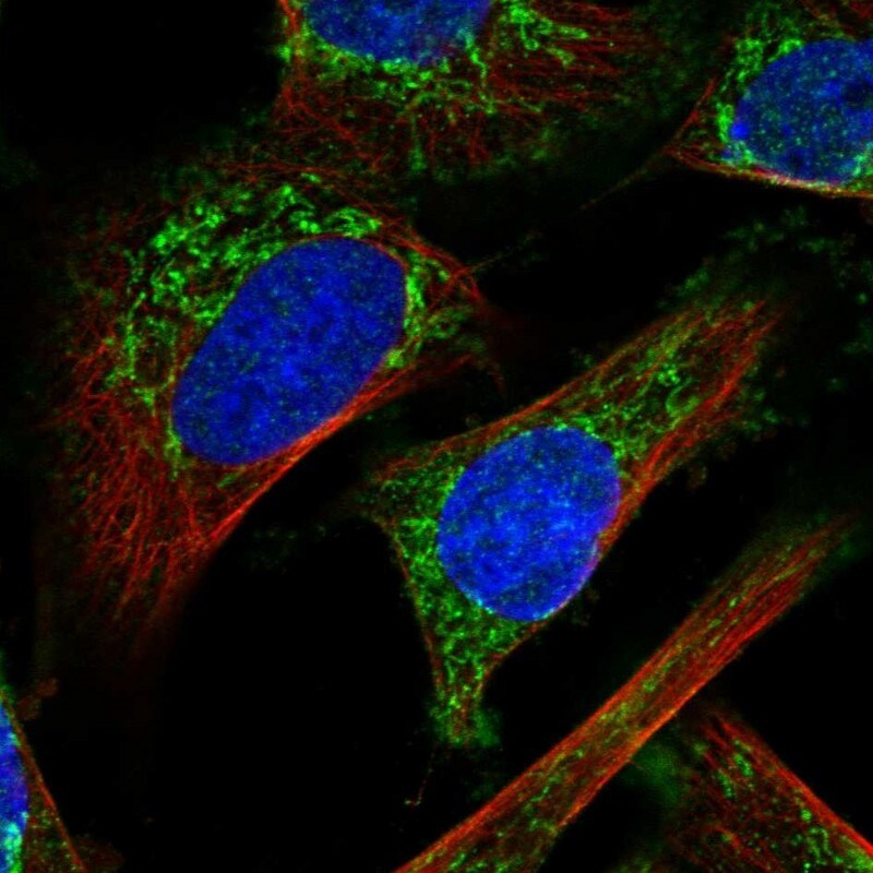 IMMP2L Antibody - BSA Free Immunocytochemistry/ Immunofluorescence: IMMP2L Antibody [NBP1-81591]