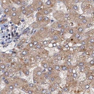 Tollip Antibody - BSA Free Immunohistochemistry-Paraffin: Tollip Antibody [NBP1-81597]