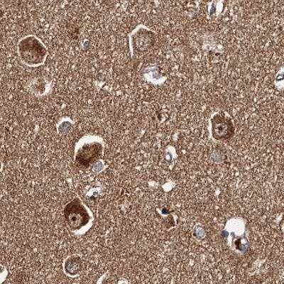 Tollip Antibody - BSA Free Immunohistochemistry-Paraffin: Tollip Antibody [NBP1-81597]