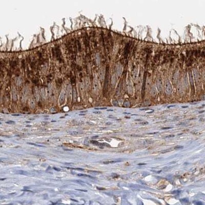 Tollip Antibody - BSA Free Immunohistochemistry-Paraffin: Tollip Antibody [NBP1-81597]