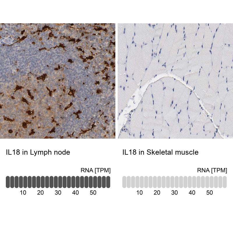 IL-18/IL-1F4 Antibody Immunohistochemistry-Paraffin: IL-18/IL-1F4 Antibody [NBP1-81607]
