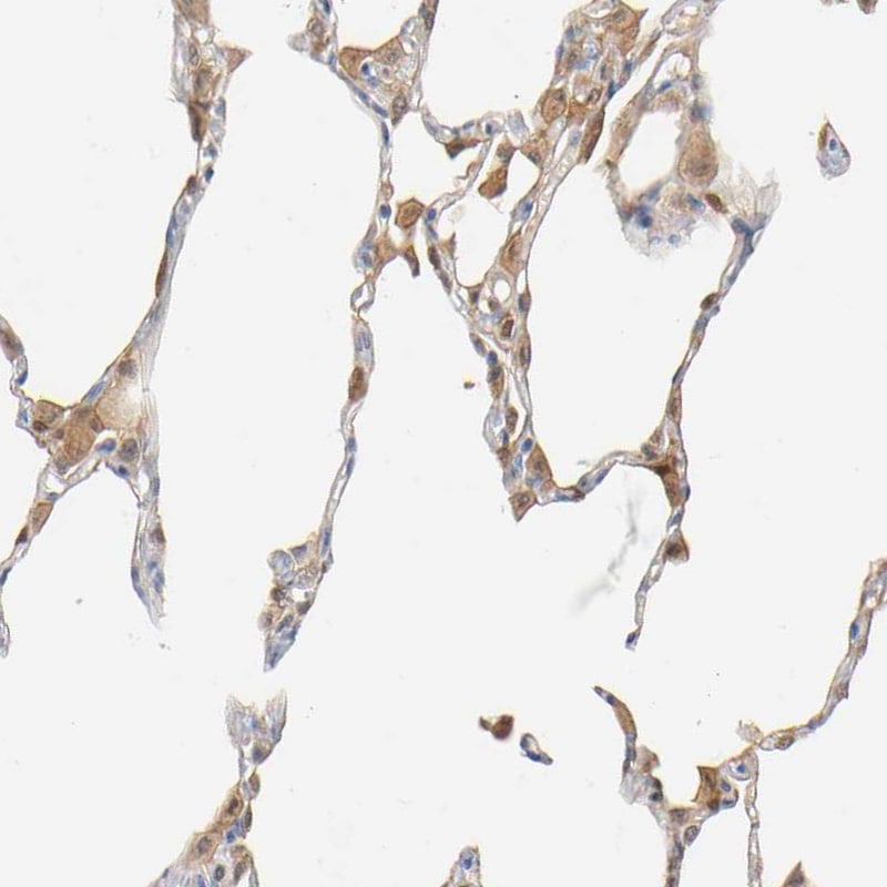 IL-18/IL-1F4 Antibody Immunohistochemistry-Paraffin: IL-18/IL-1F4 Antibody [NBP1-81607]