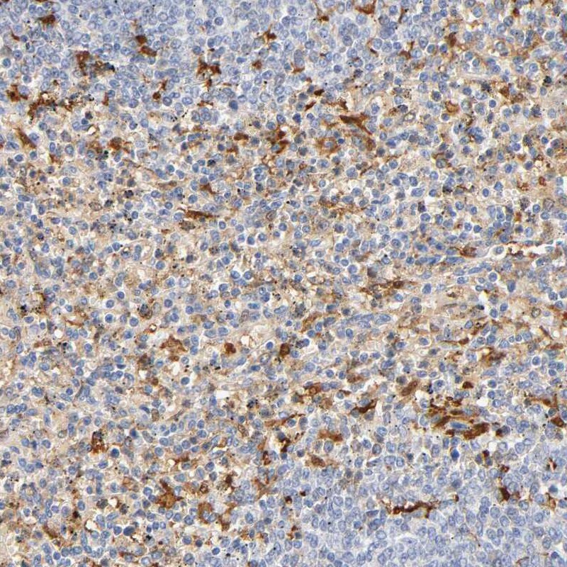 IL-18/IL-1F4 Antibody Immunohistochemistry-Paraffin: IL-18/IL-1F4 Antibody [NBP1-81607]
