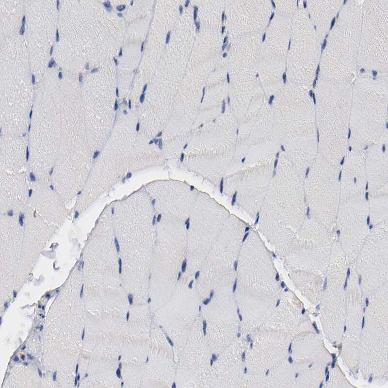 IL-18/IL-1F4 Antibody Immunohistochemistry-Paraffin: IL-18/IL-1F4 Antibody [NBP1-81607]