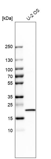IL-18/IL-1F4 Antibody Western Blot: IL-18/IL-1F4 Antibody [NBP1-81607]