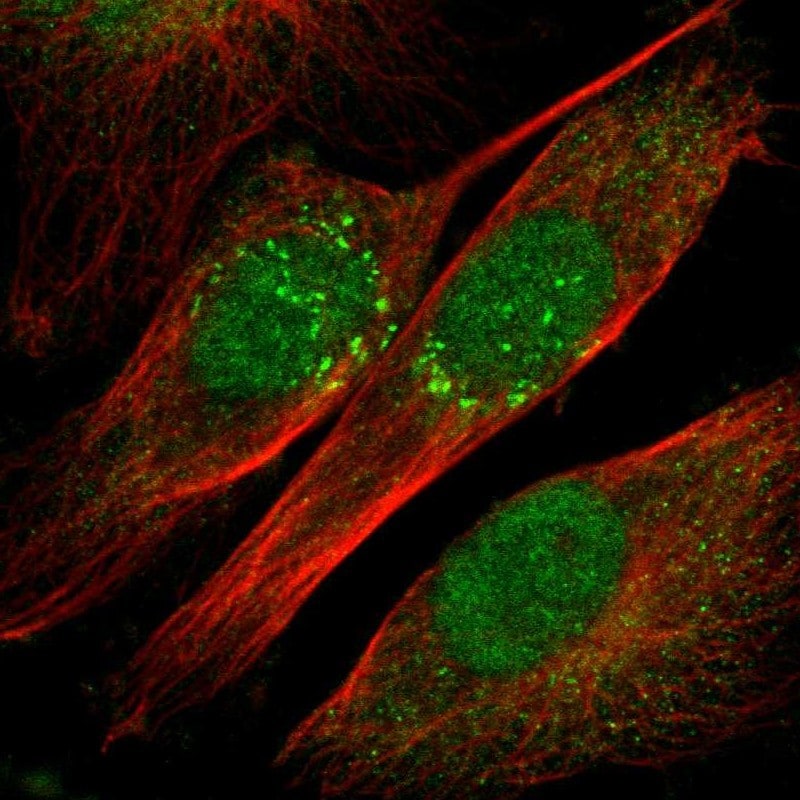 IL-18/IL-1F4 Antibody Immunocytochemistry/ Immunofluorescence: IL-18/IL-1F4 Antibody [NBP1-81607]
