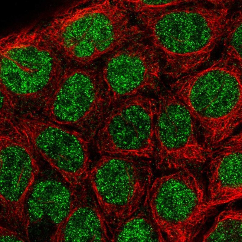 IRF8 Antibody - BSA Free Immunocytochemistry/ Immunofluorescence: IRF8 Antibody [NBP1-81614]