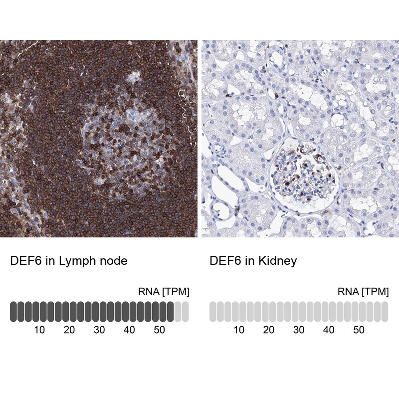 DEF6 Antibody - BSA Free Immunohistochemistry-Paraffin: DEF6 Antibody [NBP1-81618]