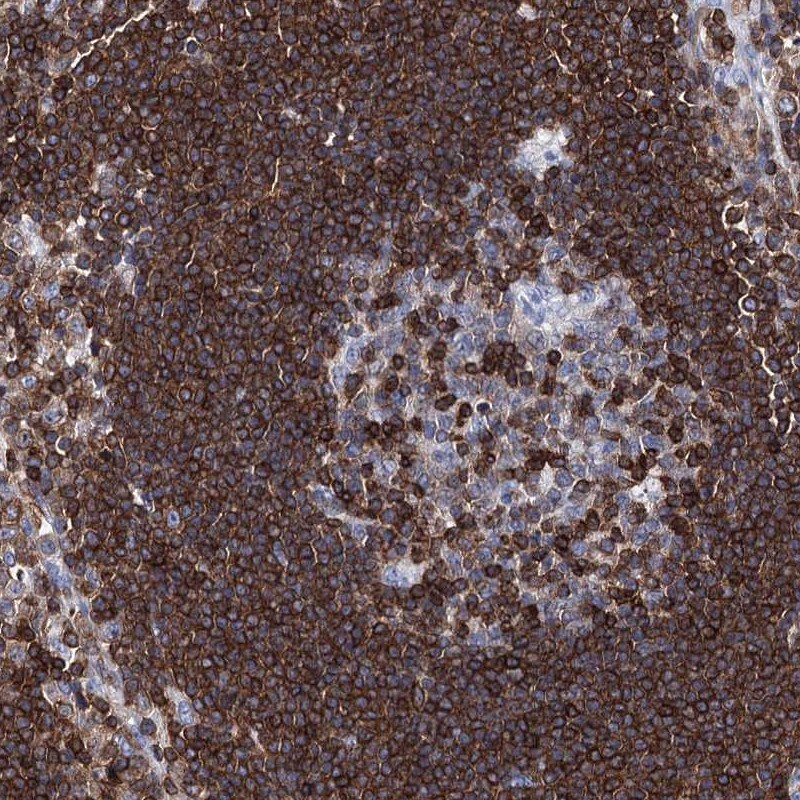 DEF6 Antibody - BSA Free Immunohistochemistry-Paraffin: DEF6 Antibody [NBP1-81618]