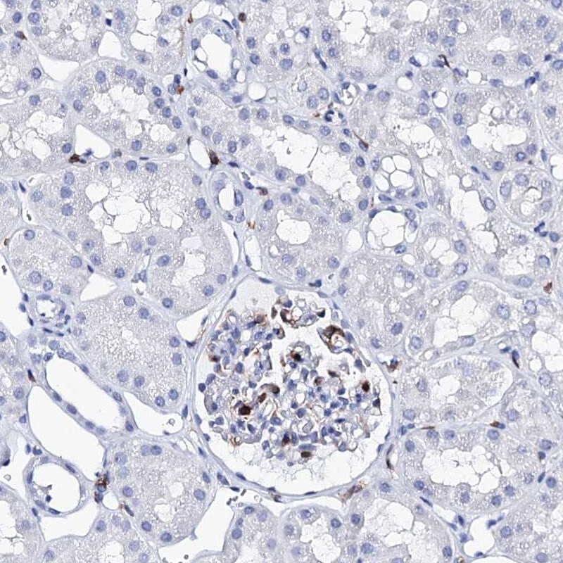 DEF6 Antibody - BSA Free Immunohistochemistry-Paraffin: DEF6 Antibody [NBP1-81618]