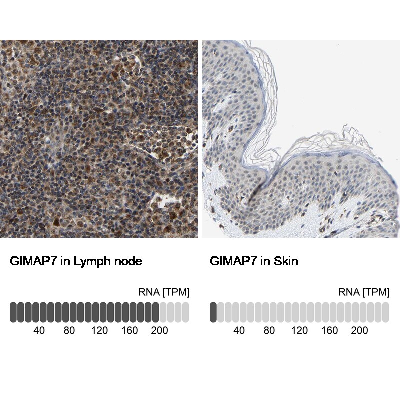 GIMAP7 Antibody - BSA Free Immunohistochemistry-Paraffin: GIMAP7 Antibody [NBP1-81624]