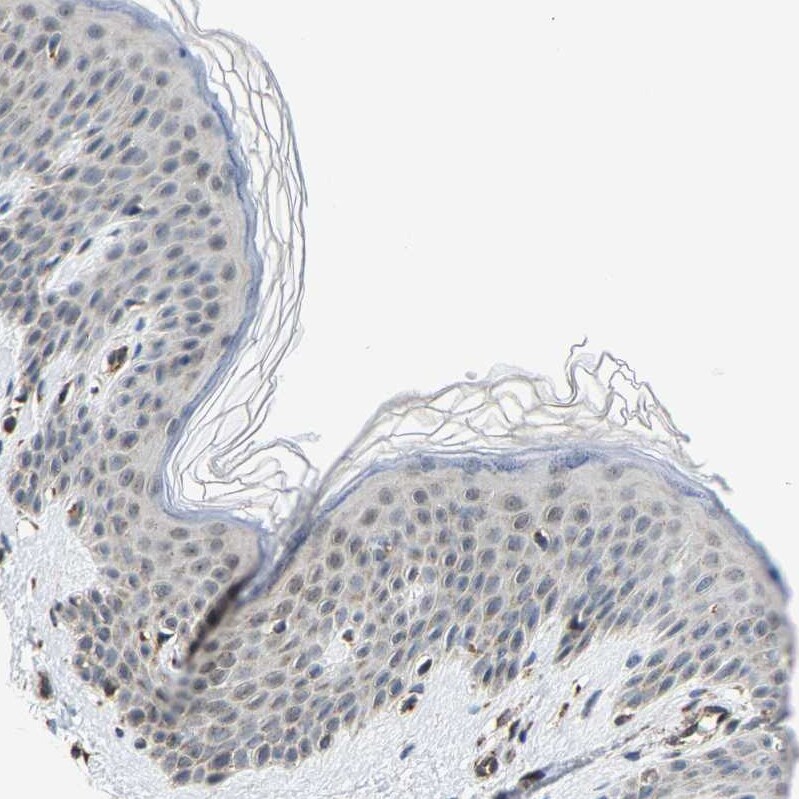 GIMAP7 Antibody - BSA Free Immunohistochemistry-Paraffin: GIMAP7 Antibody [NBP1-81624]