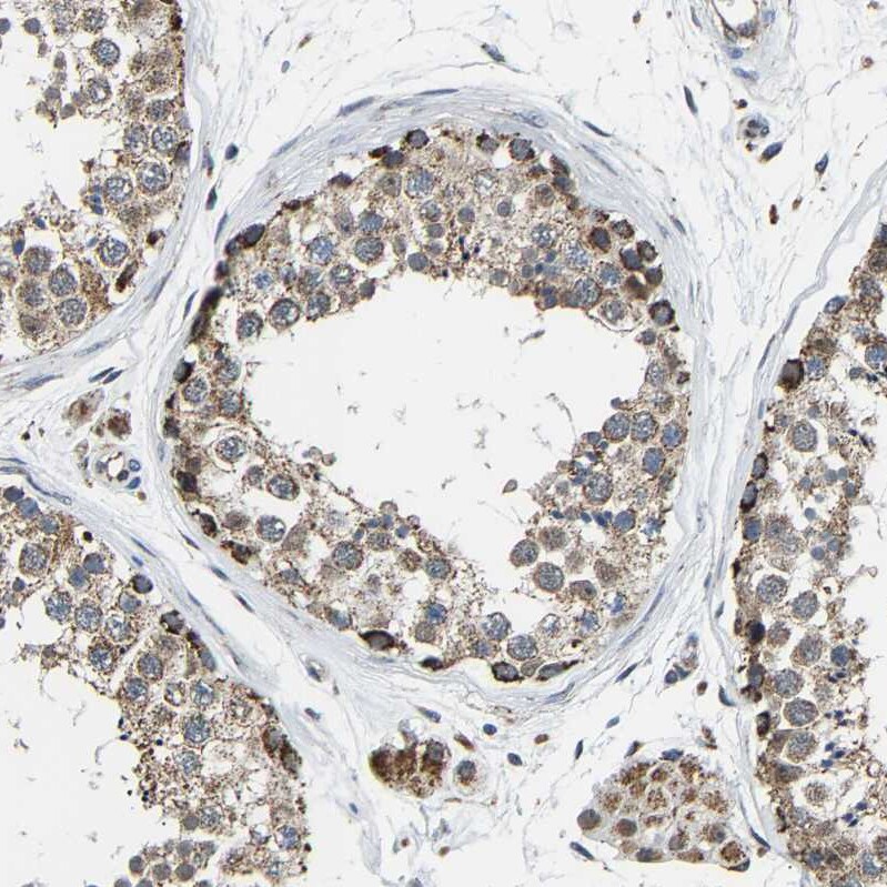 GIMAP7 Antibody - BSA Free Immunohistochemistry-Paraffin: GIMAP7 Antibody [NBP1-81624]