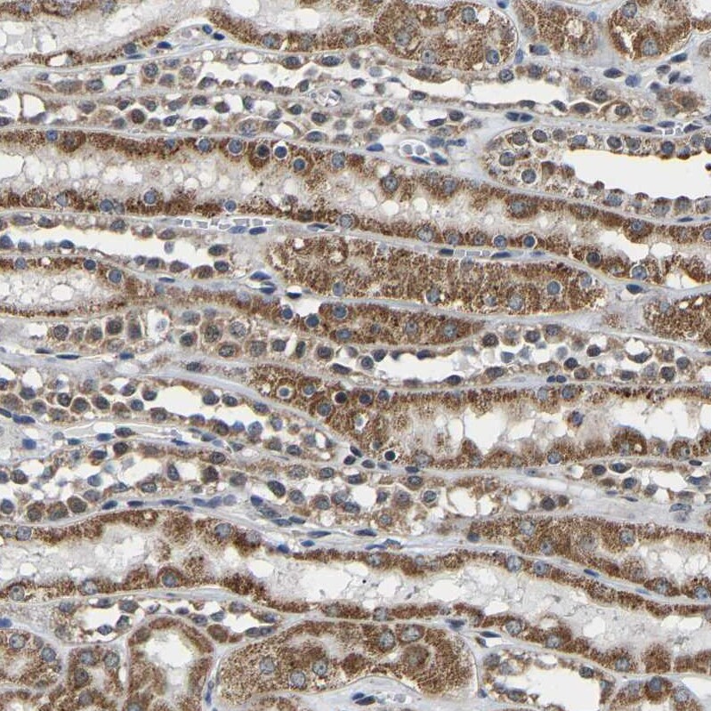 GIMAP7 Antibody - BSA Free Immunohistochemistry-Paraffin: GIMAP7 Antibody [NBP1-81624]