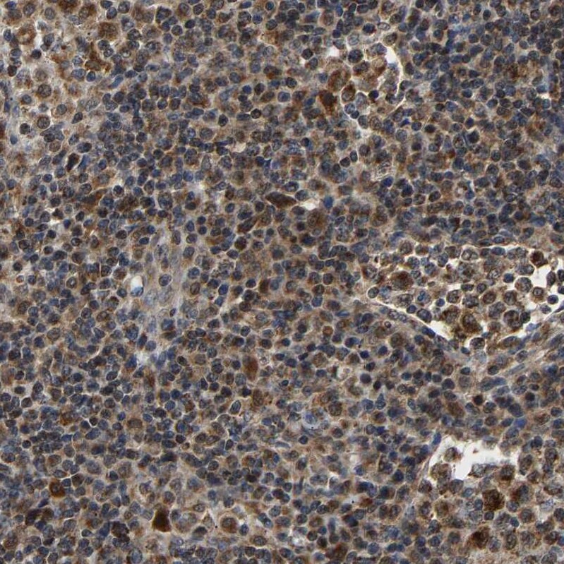 GIMAP7 Antibody - BSA Free Immunohistochemistry-Paraffin: GIMAP7 Antibody [NBP1-81624]