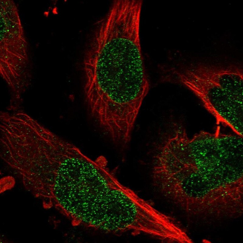 ZNF124 Antibody - BSA Free Immunocytochemistry/ Immunofluorescence: ZNF124 Antibody [NBP1-81634]