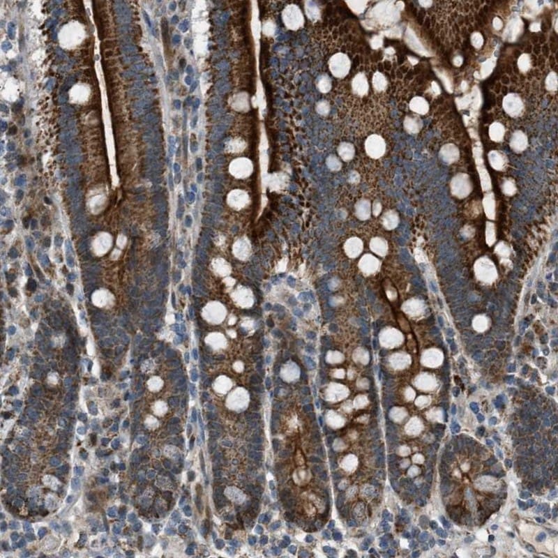 VPS41 Antibody - BSA Free Immunohistochemistry-Paraffin: VPS41 Antibody [NBP1-81640]