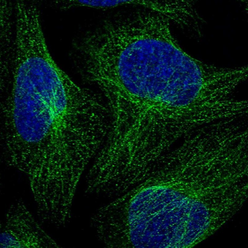 VPS45 Antibody - BSA Free Immunocytochemistry/ Immunofluorescence: VPS45 Antibody [NBP1-81642]