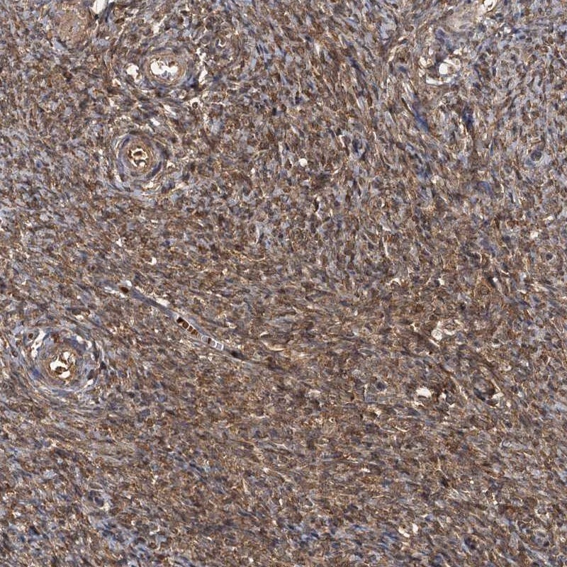 HYI Antibody - BSA Free Immunohistochemistry-Paraffin: HYI Antibody [NBP1-81659]