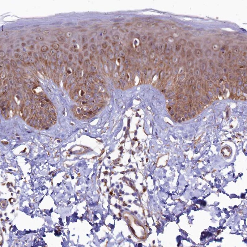ASTE1 Antibody - BSA Free Immunohistochemistry-Paraffin: ASTE1 Antibody [NBP1-81661]