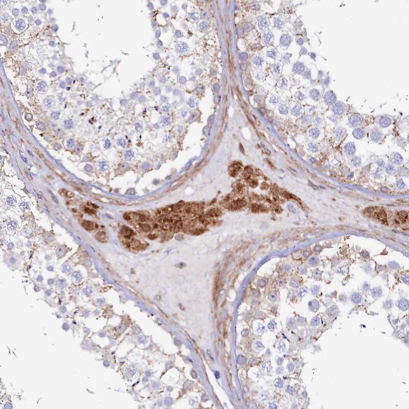 ASTE1 Antibody - BSA Free Immunohistochemistry-Paraffin: ASTE1 Antibody [NBP1-81661]