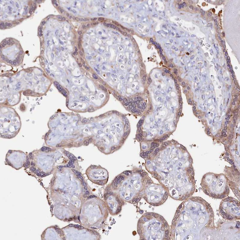 ASTE1 Antibody - BSA Free Immunohistochemistry-Paraffin: ASTE1 Antibody [NBP1-81661]