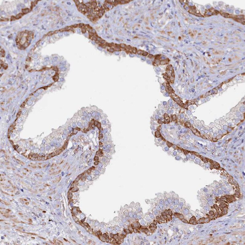 ASTE1 Antibody - BSA Free Immunohistochemistry-Paraffin: ASTE1 Antibody [NBP1-81661]